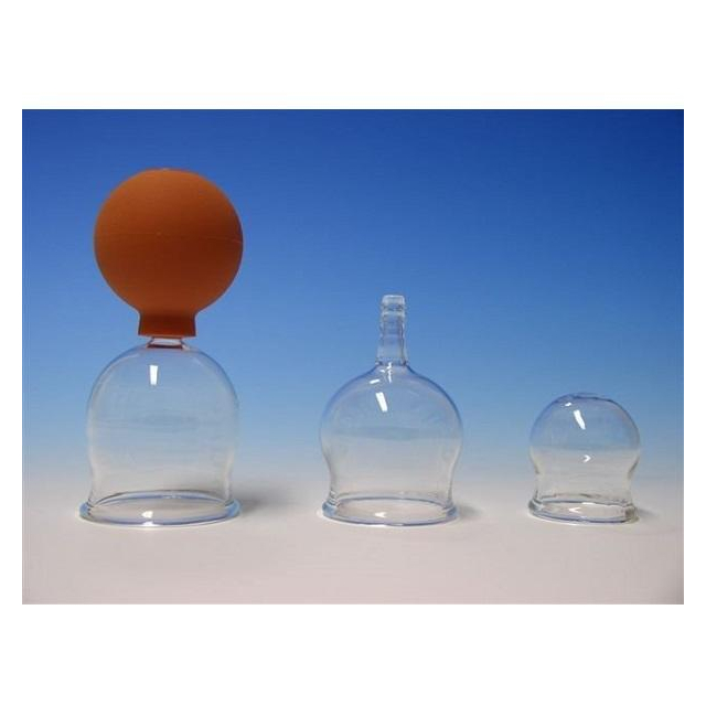 Schröpfgläser Schröpfglasbehandlung
