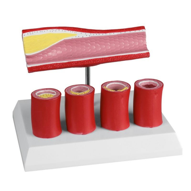 Arterie mit 4 Arterienschnitten