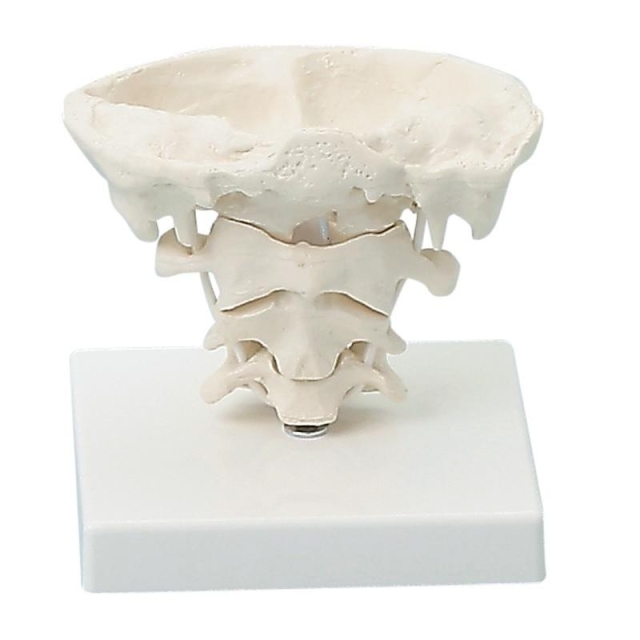 Kopfgelenke natürlich und vergrößert